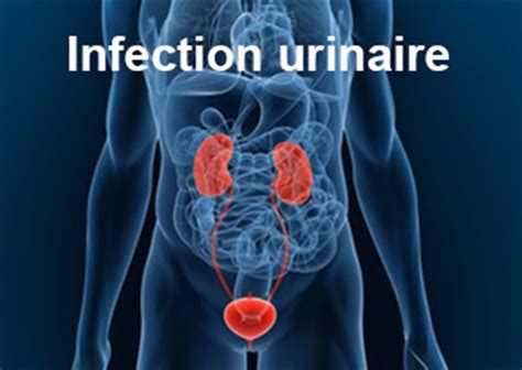 sodomie et infection urinaire|symptômes et causes de linfection urinaire